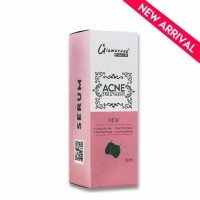 acne treatment face water 200x200